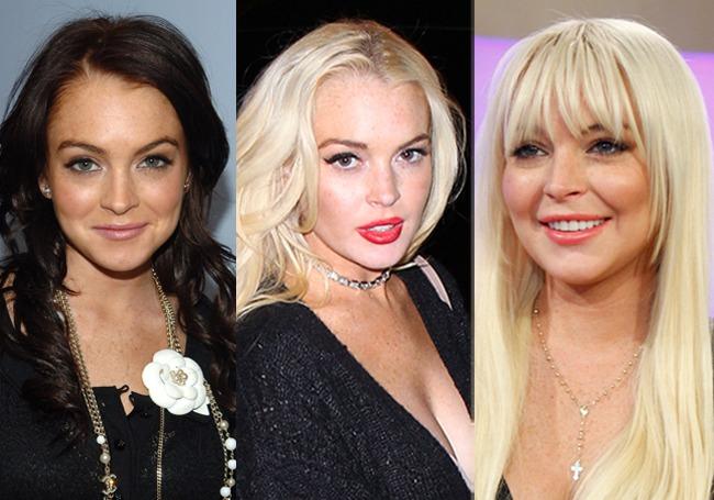 10 Celebrities That Changed A Lot After Plastic Surgery