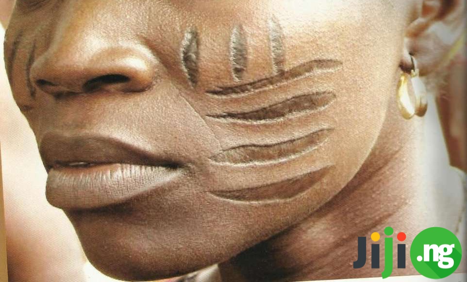 how to get rid of tribal marks